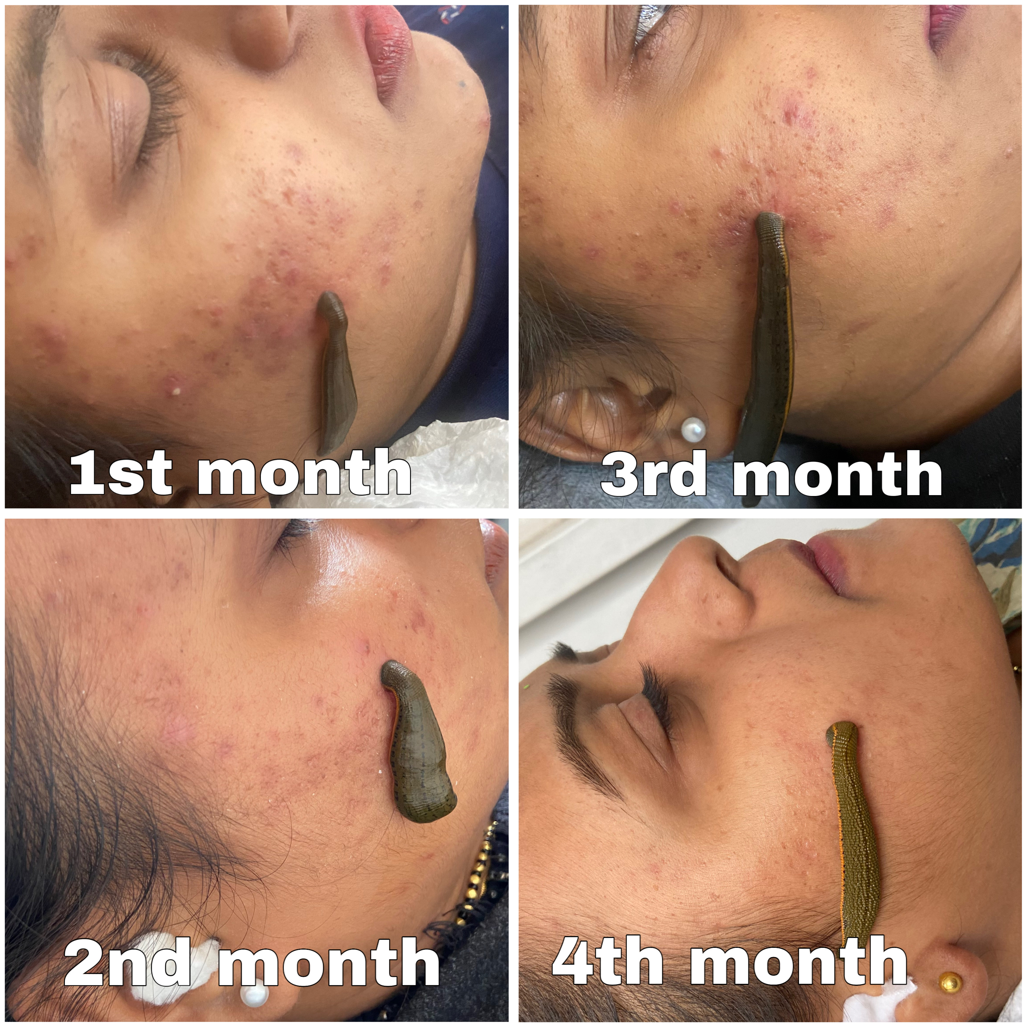 Shree Vishwavijaya Clinic - leech c