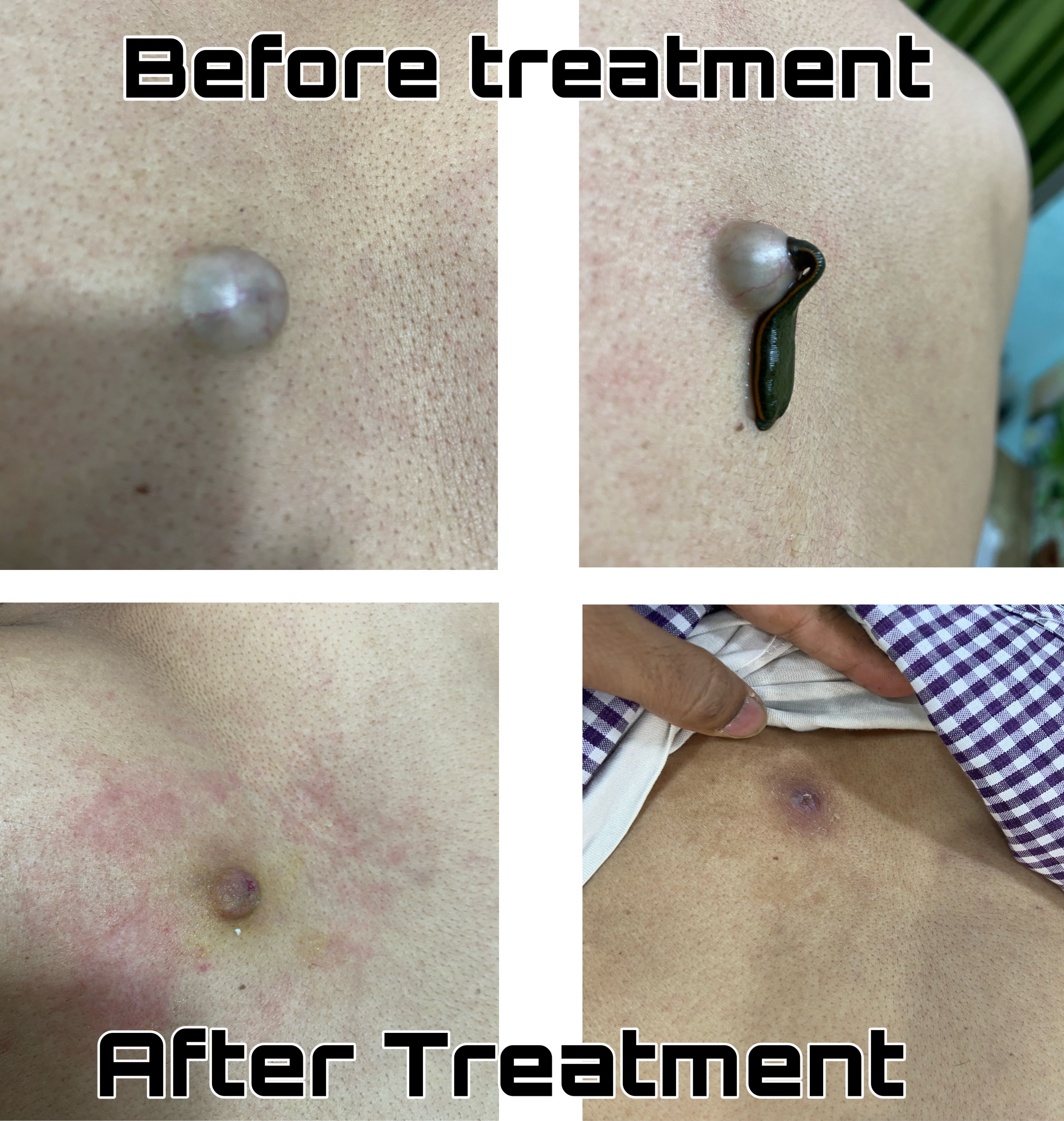 Shree Vishwavijaya Clinic - leech c